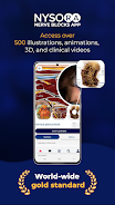 NYSORA Nerve Blocks ဖန်သားပြင်ဓာတ်ပုံ 1