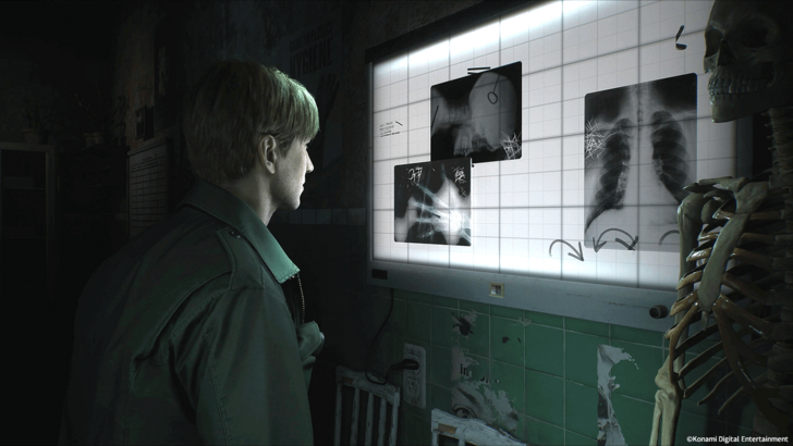 Maaaring Ibunyag ng Silent Hill 2 Remake Photo Puzzle ang Teorya ng Minamahal na Tagahanga