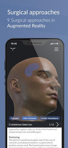 UpSurgeOn Neurosurgery应用截图第3张