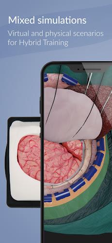 UpSurgeOn Neurosurgery应用截图第1张