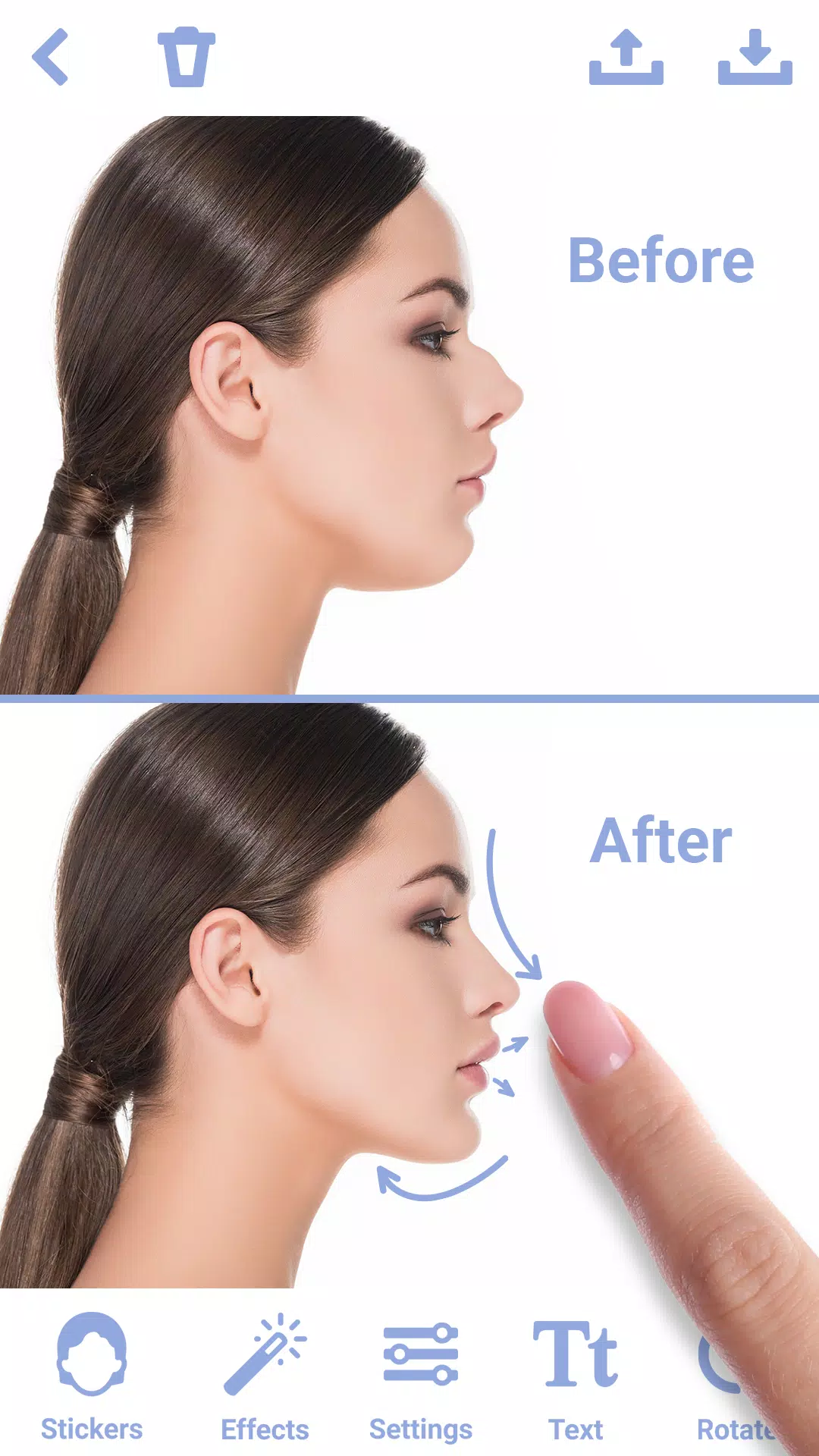 Rhinoplasty 스크린샷 1