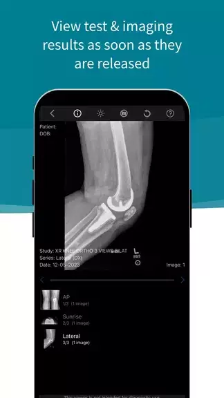 Schermata Stanford Health Care MyHealth 4