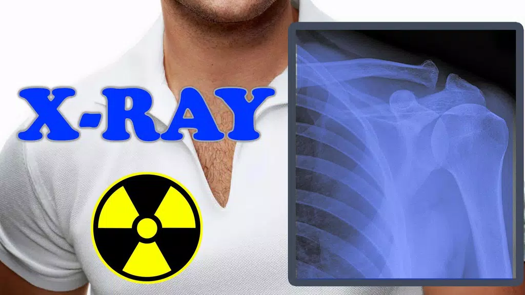 X-Ray Filter Photo Скриншот 3