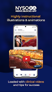 NYSORA Nerve Blocks ဖန်သားပြင်ဓာတ်ပုံ 3